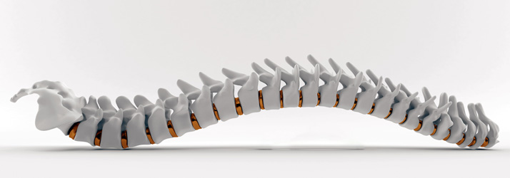 Spinal Decompression Pompano Beach